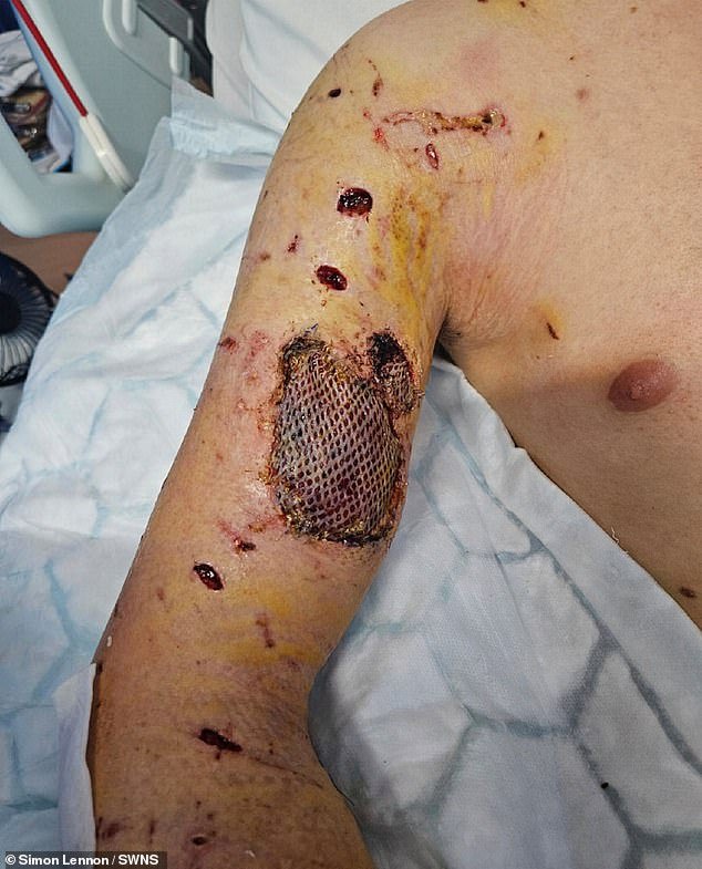 Un luchador aficionado de MMA luchó valientemente contra XL Bully, quien lo arrojó “como un muñeco de trapo” en un ataque salvaje, y atribuye su “milagrosa” supervivencia al entrenamiento.