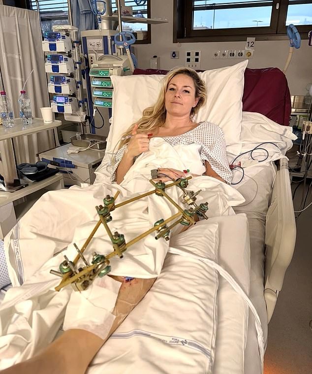 Lindsey Vonn insinúa que volverá a esquiar a pesar de su cuarta operación por su pierna rota tras un terrible accidente en los Juegos Olímpicos de Invierno