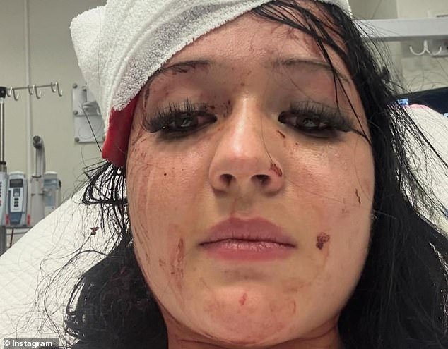 La hermana de una mujer de 20 años, que supuestamente fue apuñalada por un colega rechazado en un club de liga, cuenta cómo se desarrolló el horrible ataque y elogia al héroe que le salvó la vida.