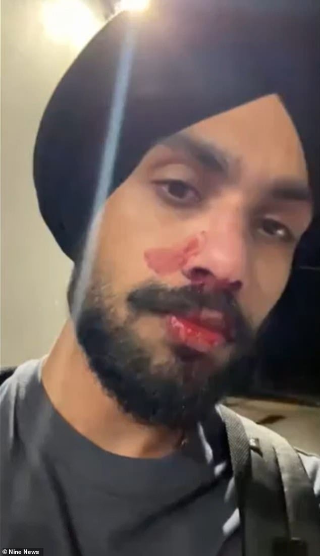 ‘Vuelve a tu barco’: A un joven enfermero se le rompe la nariz después de sufrir abusos raciales y un cabezazo cuando salía del gimnasio Planet Fitness, Corio