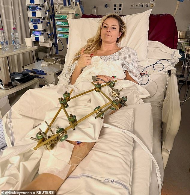 Lindsey Vonn responde a los ‘haters’ desde su cama de hospital después de que le dijeran que era ‘egoísta’ por ganar un lugar olímpico antes de una pausa de terror a los 41 años.