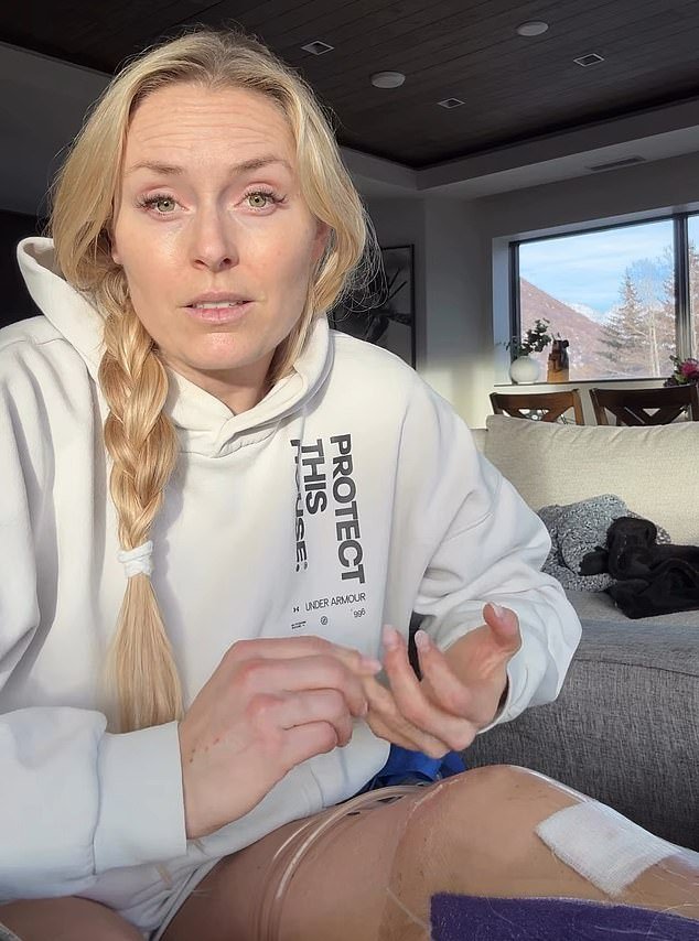 Lindsey Vonn habla sobre la lucha mental ‘oscura e implacable’ después del accidente de los Juegos Olímpicos de Invierno: ‘Me golpeó como una tonelada de ladrillos’