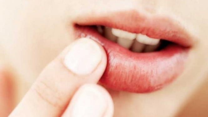 Los labios secos durante el ayuno te hacen sentir incómodo, aquí tienes 9 formas de superarlo