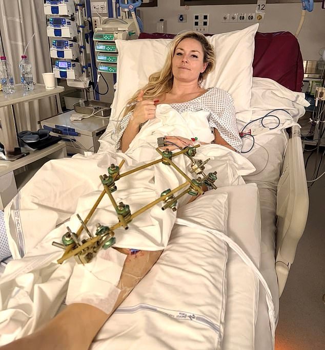 106393909-15647777-Vonn_came_close_to_losing_her_leg_earlier_after_crashing_at_the_-a-1_1773576004900.jpg
