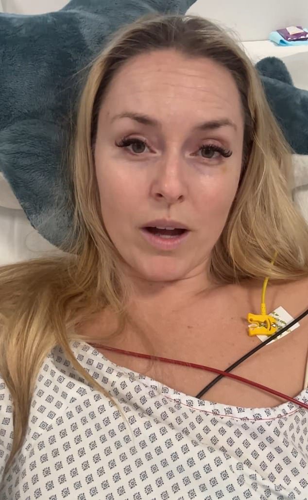 Lindsey Vonn llora al perder el prestigioso honor de esquiar después de una horrible fractura en la pierna
