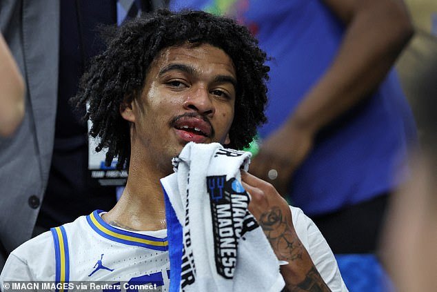 La estrella de March Madness pierde su DIENTE después de un repugnante codazo en la cara… antes de que su compañero de equipo lo encuentre en la cancha