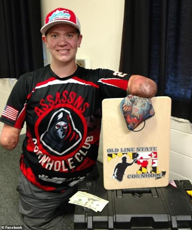 Un jugador profesional de cornhole sin brazos ni piernas se enfrenta a escalofriantes cargos de asesinato… pero es sólo el último giro de una historia de vida verdaderamente impactante.