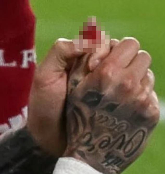 Galatasaray amenaza con demandar al Liverpool: el jefe de Turquía hace sonar la alarma después de que una estrella se corta el pulgar en un extraño accidente con un cartel publicitario en Anfield, mientras comparte la actualización desde la cama del hospital