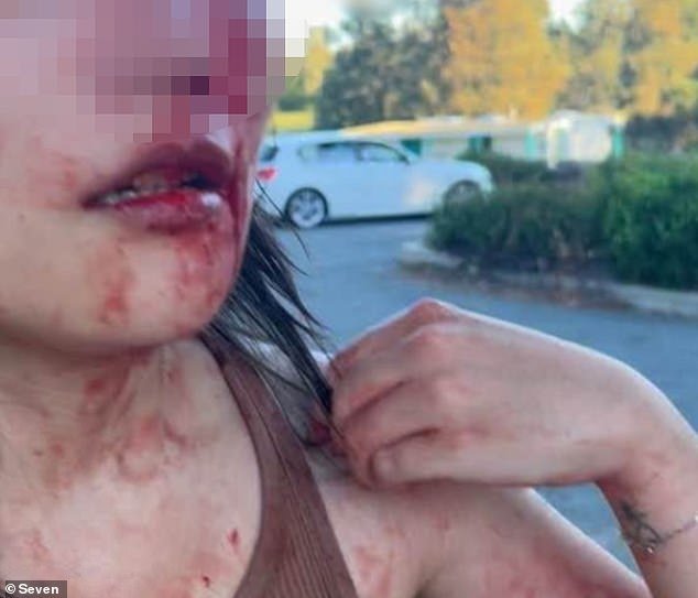 Canberra al límite después de que otra mujer golpeara al azar y amenazara con un cuchillo a otra mujer en un vil ataque racista