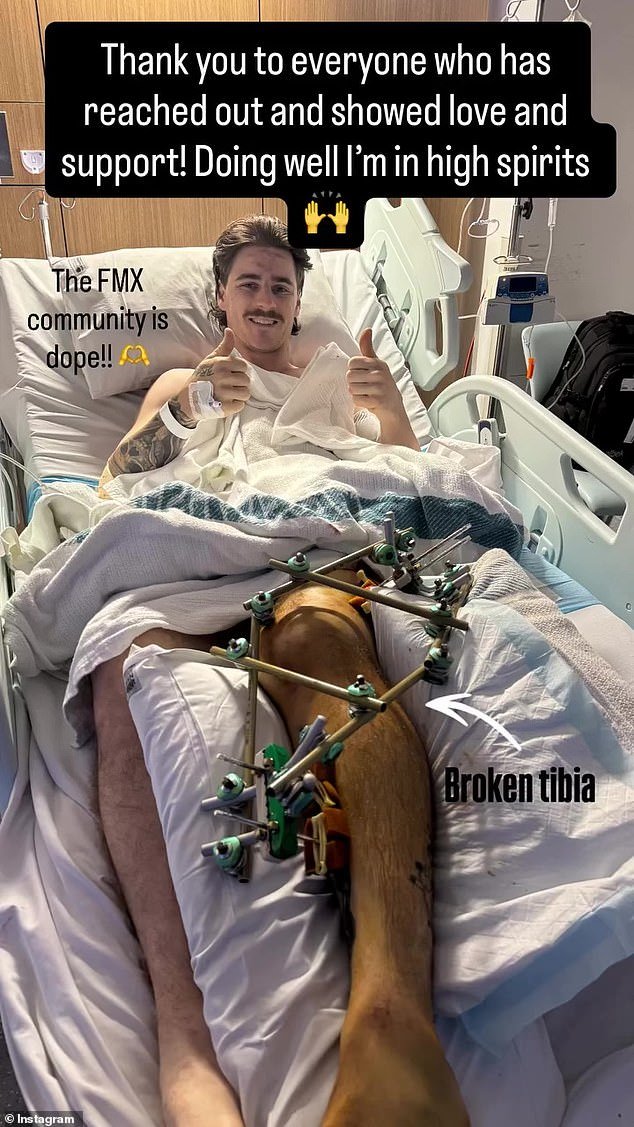 Mensaje de un motociclista de motocross herido desde el hospital después de un accidente catastrófico en el Sydney Royal Easter Show, mientras su esposa embarazada revela “un largo camino por delante”