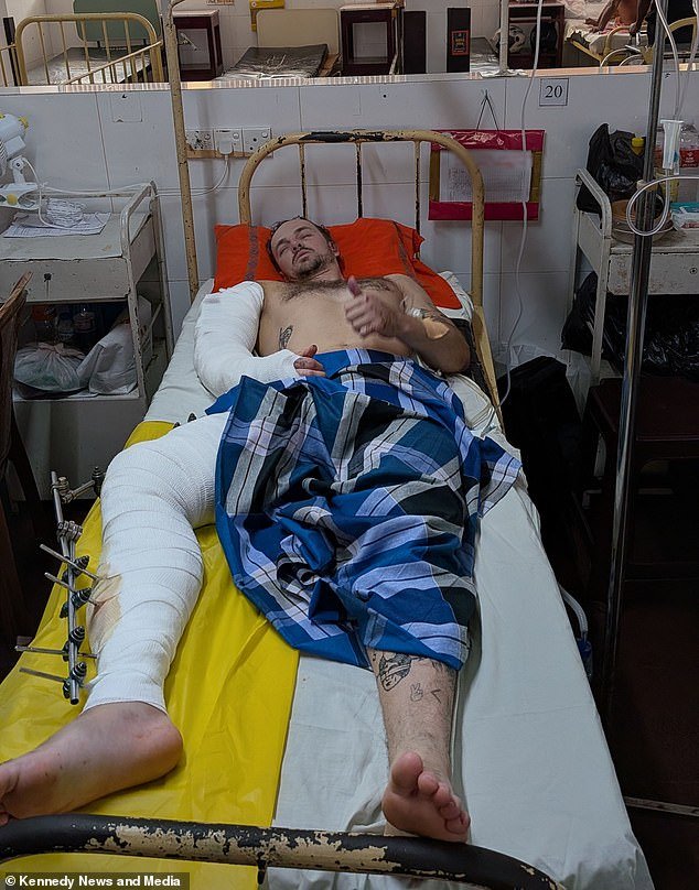 Un turista británico está atrapado en el hospital con una factura de 40.000 libras esterlinas debido a problemas técnicos con el seguro después de haber sido atropellado en una motocicleta tres horas después de llegar a Sri Lanka.